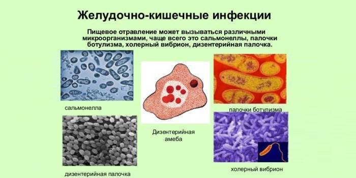 Gastrointestinálne infekcie