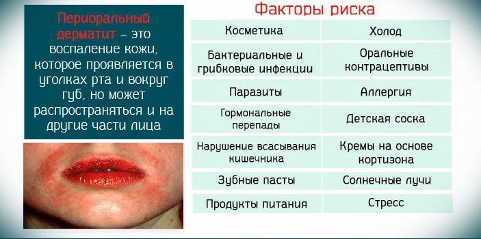 Causas e fatores de risco para dermatite perioral