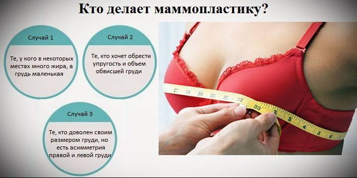 Indikácie pre mamoplastiku