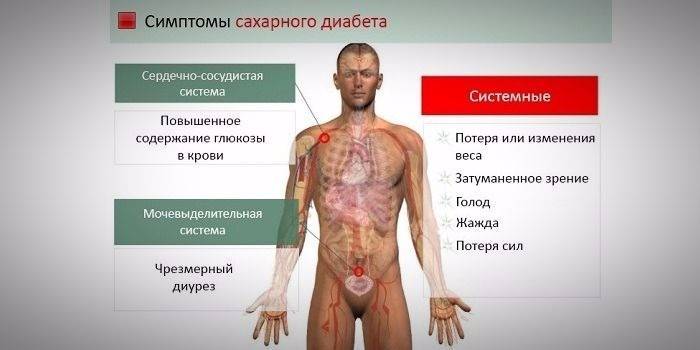 Sintomas de diabetes no esquema