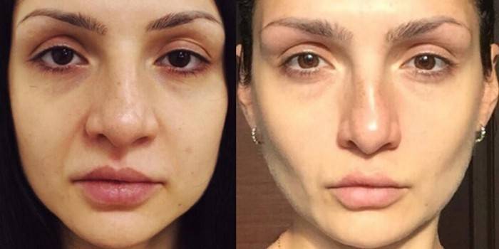 Carol Maggio Methods - Fotos Antes e Depois