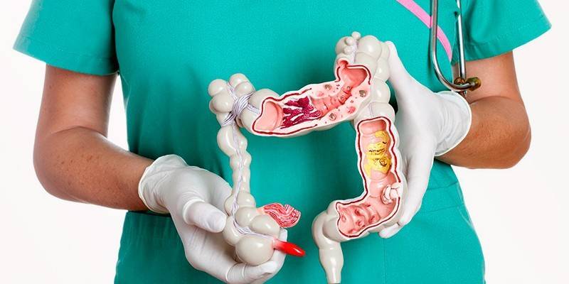 La disposición de los intestinos humanos.