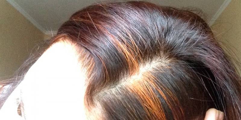 Manchas desiguales de canas