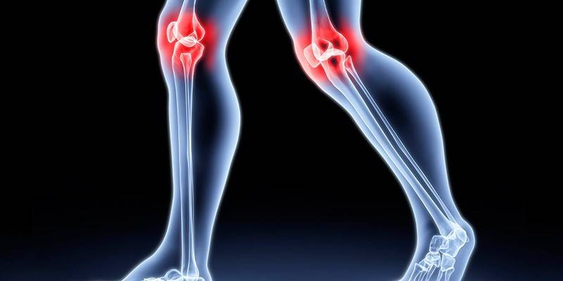 Inflamação articular do joelho