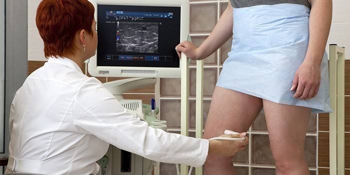 Žena sa podrobuje angiografii ciev nôh