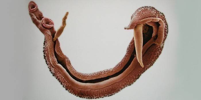Esquistossoma