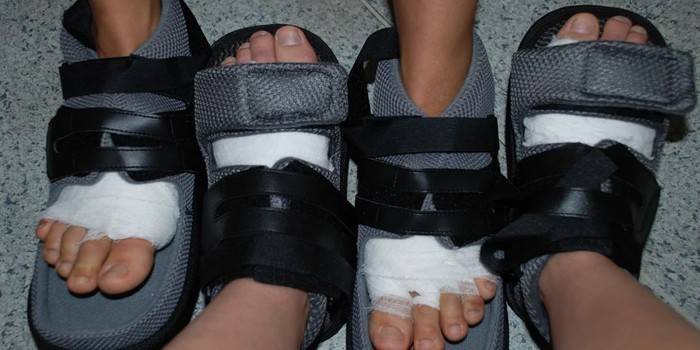 Buty rehabilitacyjne pooperacyjne