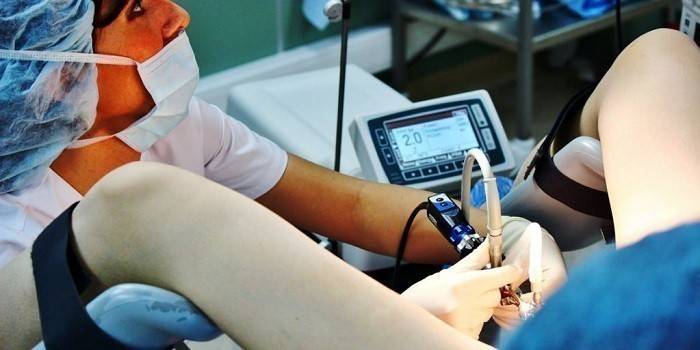 El médico realiza una histeroscopia del útero.