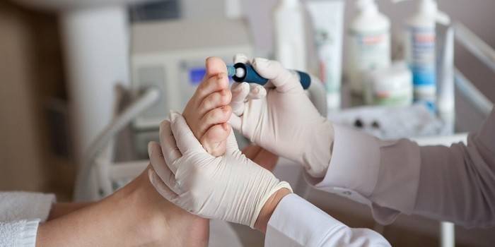 Przeprowadzanie pedicure sprzętu medycznego