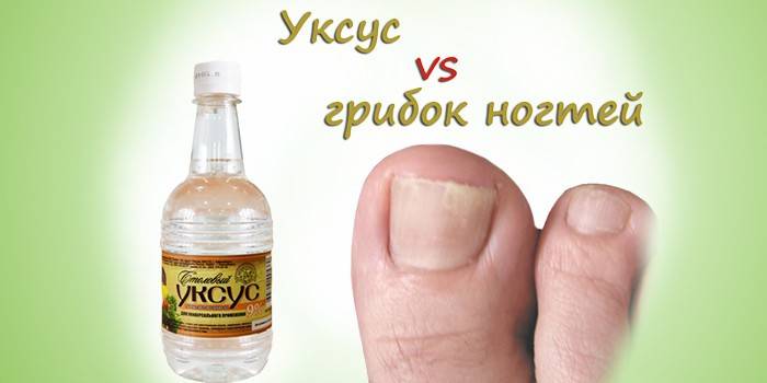 Ocet grzybowy do paznokci