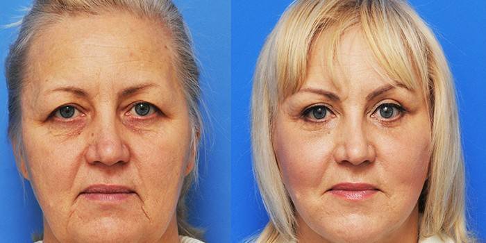 Carol Maggio Methods - Fotos Antes e Depois
