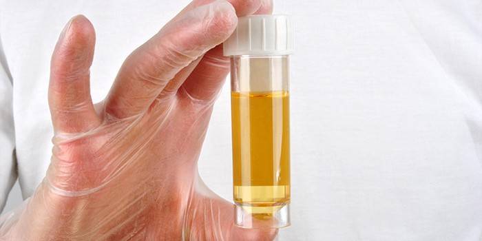 Urina in vitro