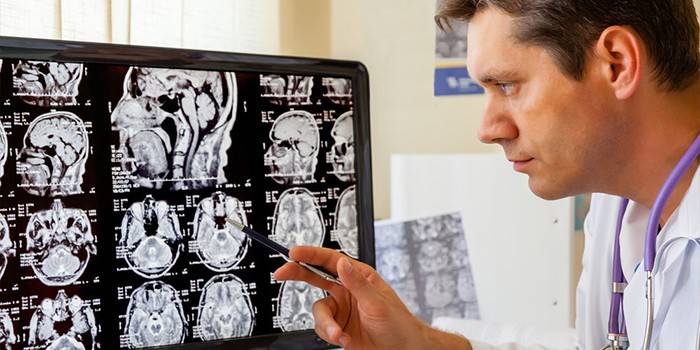 O médico examina as imagens em camadas do cérebro humano em um monitor