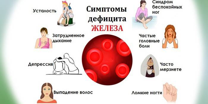 Objawy niedoboru żelaza
