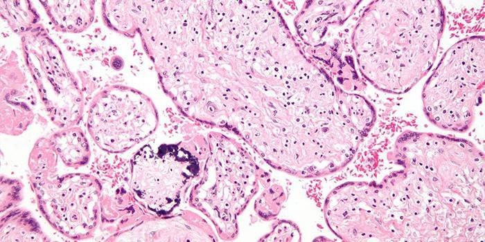 Cytomegalovírus pod mikroskopom