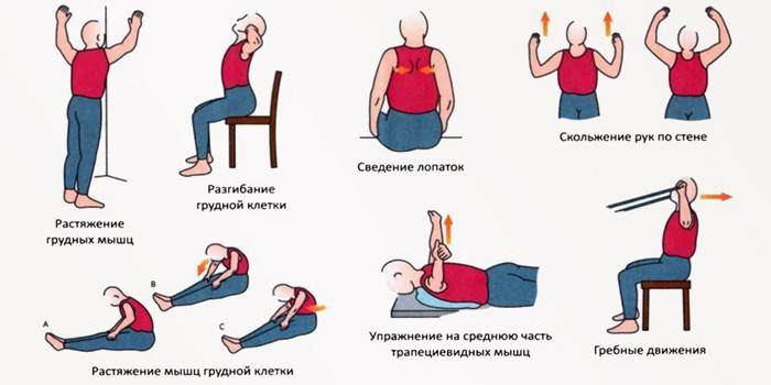 Cvičenie na cervikálnu osteochondrózu
