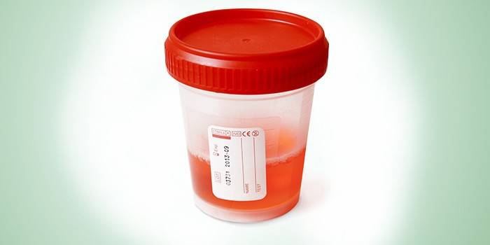 Urinálise em um recipiente