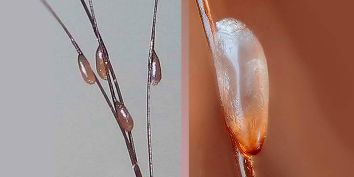 Larva en cabello