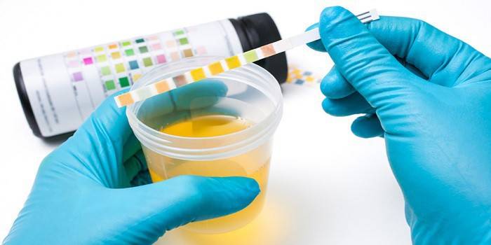 Laboratório de urinálise