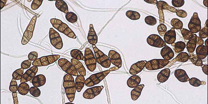 Rozmnażanie grzyba alternaria alternata