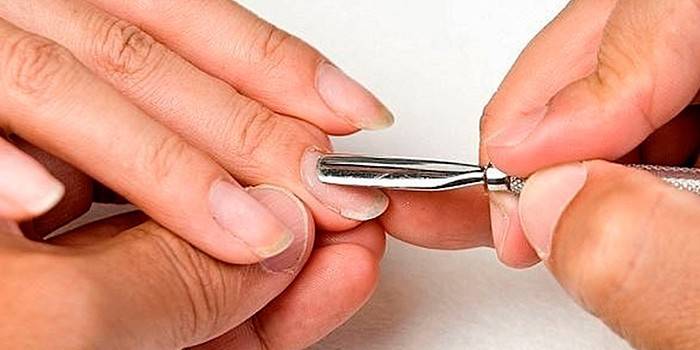 Correção do gel após o fortalecimento