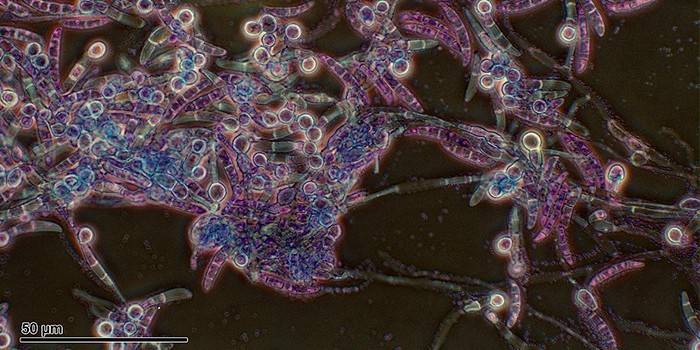 Baktérie Pythium pod mikroskopom