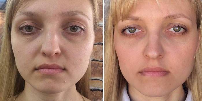 Fotos antes e depois da ginástica