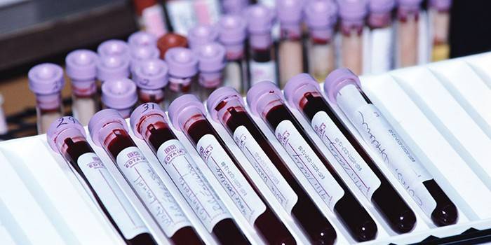 Krvné testy in vitro