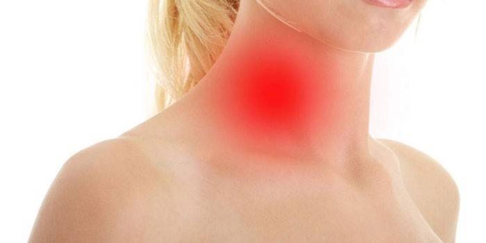 Dolor de garganta