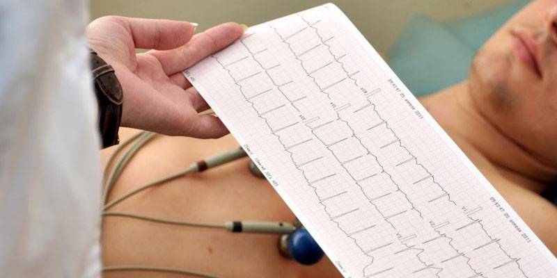 Cardiograma do coração