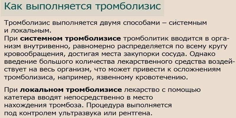 Rodzaje procedur