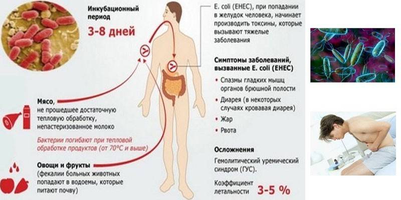 Escherichiose: sintomas e complicações