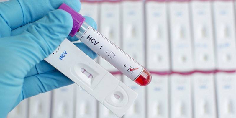 Дешифриране на резултатите от кръвен тест за хепатит