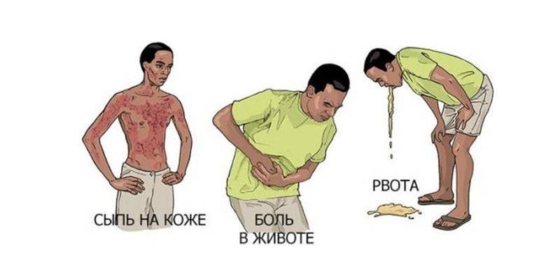 Síntomas del cáncer de intestino