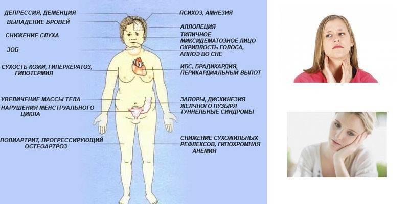 Σημάδια ανεπάρκειας ιωδίου στο σώμα μιας γυναίκας