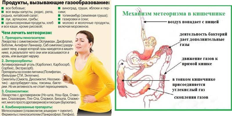 Alimentos de flatulência e flatulência