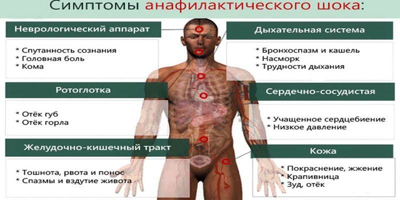 Συμπτώματα αναφυλακτικού σοκ
