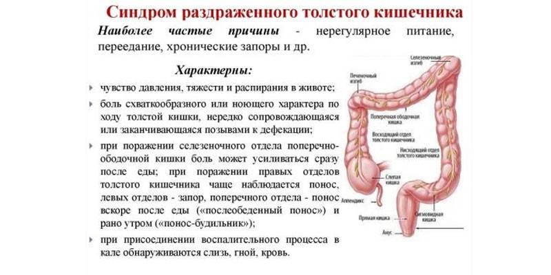 Sintomas da Síndrome do Intestino Irritável