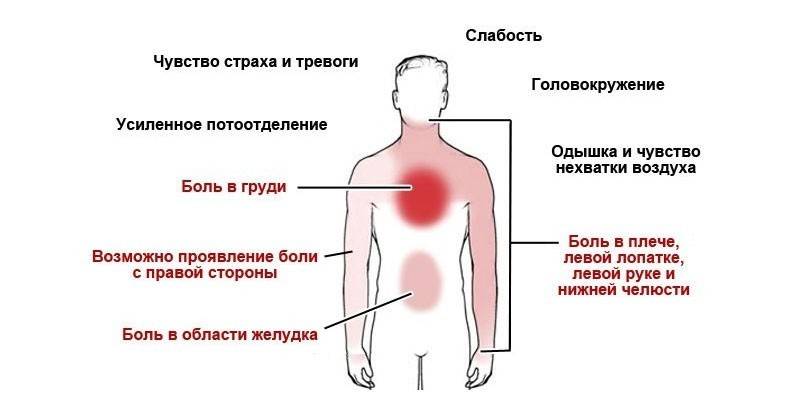 Známky angíny pektoris