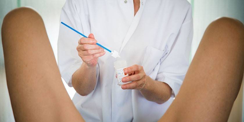 Esfregaço vaginal