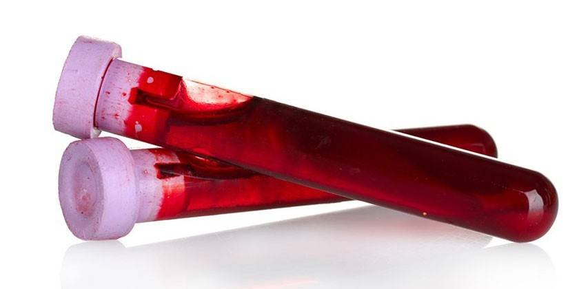 Prueba de sangre