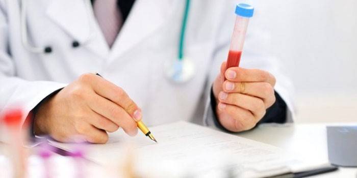 Tubo de ensaio com biomaterial na mão do médico