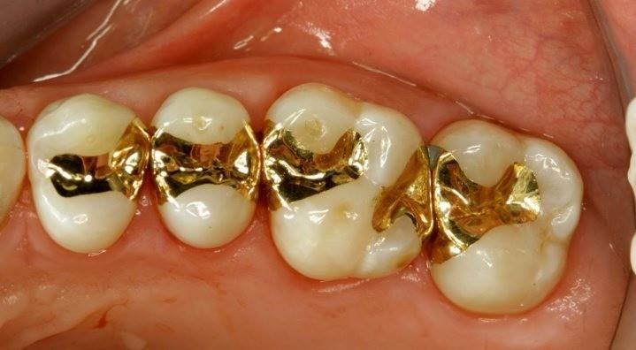 Guias de ouro