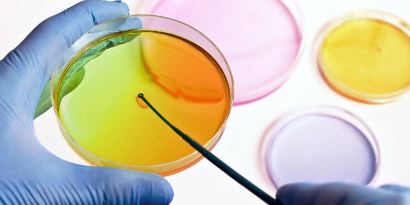 Szalka Petriego w rękach asystenta laboratoryjnego