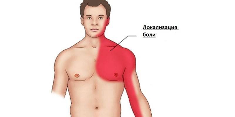 Localización del dolor del ataque al corazón
