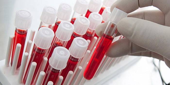 Análisis de sangre in vitro