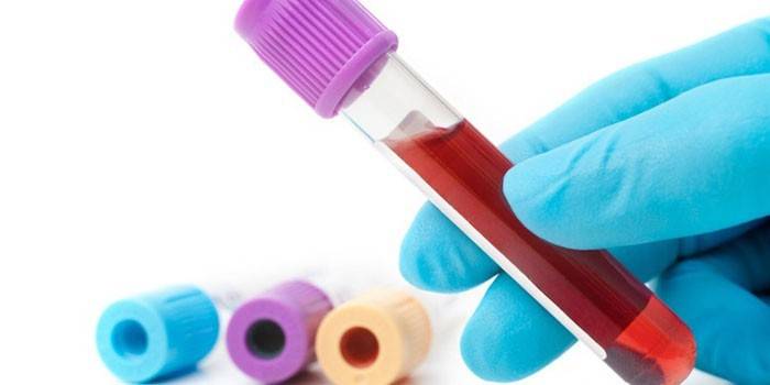 Exame de sangue