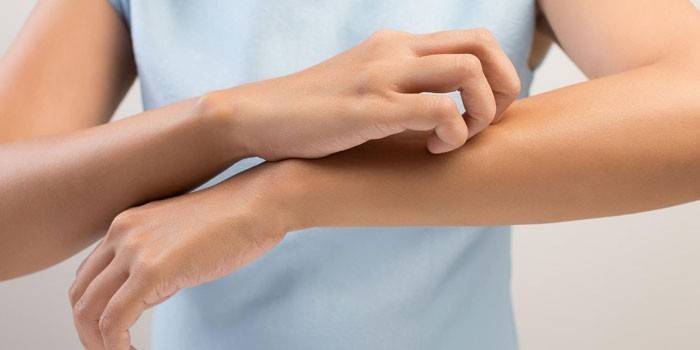 Picazón en el brazo