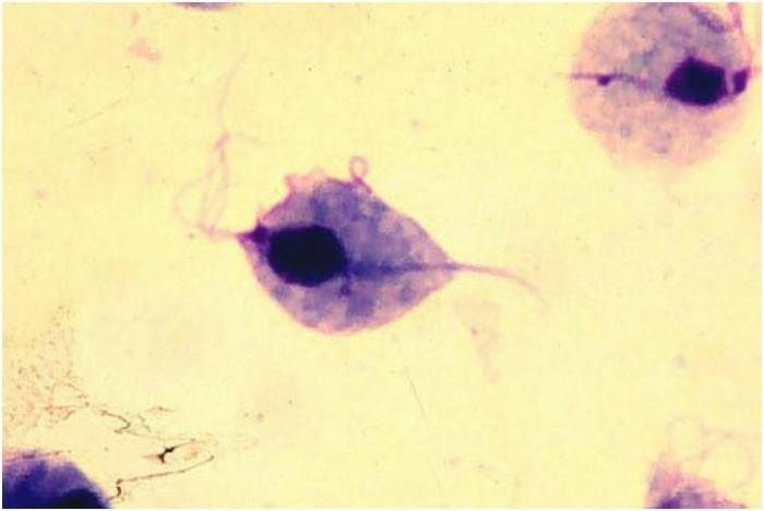 Trichomonas