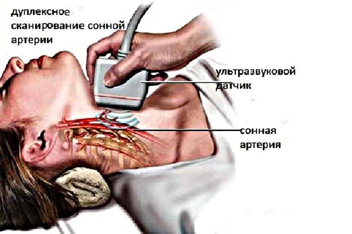 Skenovanie krčných ciev